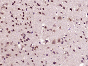 ZCCHC10 Rabbit Polyclonal Antibody