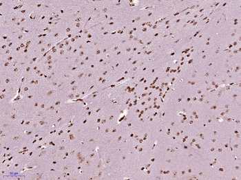 ZCCHC6 Rabbit Polyclonal Antibody
