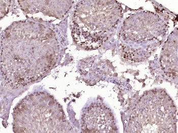 ZNF743 Rabbit Polyclonal Antibody