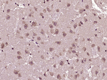 Phospho-14-3-3 beta + zeta (Ser186 / Ser184) Rabbit Polyclonal Antibody
