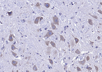 Neurotrophin 3 Rabbit Polyclonal Antibody