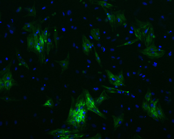 Cardiac Troponin T Rabbit Polyclonal Antibody (FITC)