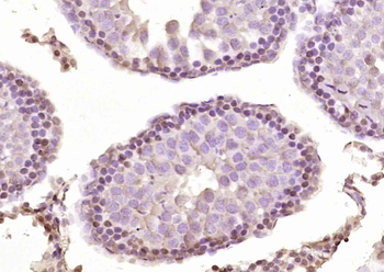FNDC8 Rabbit Polyclonal Antibody