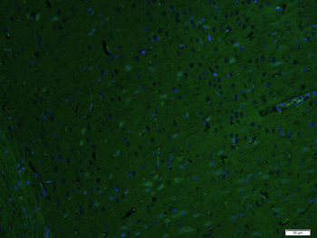 Matrilin 2 Rabbit Polyclonal Antibody (FITC)