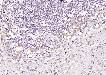 DENND2D Rabbit Polyclonal Antibody