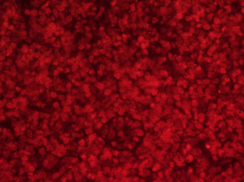 SIP1 Rabbit Polyclonal Antibody