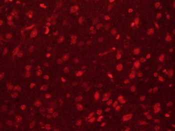 SIP1 Rabbit Polyclonal Antibody