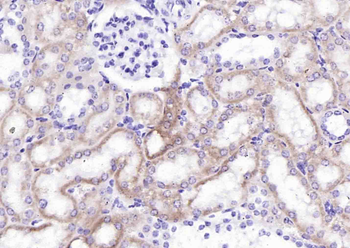 IGSF1 Rabbit Polyclonal Antibody