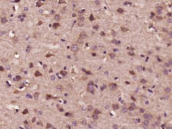 HPRT Rabbit Polyclonal Antibody