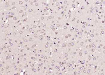 FRMPD2 Rabbit Polyclonal Antibody