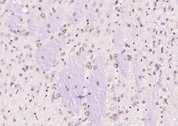 FRMPD2 Rabbit Polyclonal Antibody