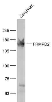FRMPD2 Rabbit Polyclonal Antibody