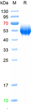 Recombinant human SERPINB3 protein, C-His (HEK293)