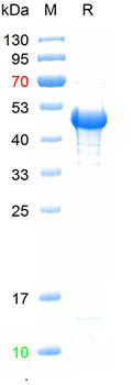 Recombinant Mumps virus Fusion glycoprotein F0 protein, N-His