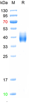 Recombinant human Fc gamma RIIIB / CD16b (NA2) Protein; C-His (HEK293)