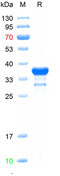 Recombinant human JAK1 protein, N-His