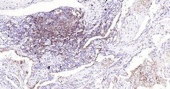 Human HLA-DR Ready-To-Use IHC Kit