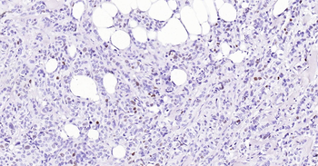Human P53 Ready-To-Use IHC Kit