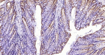 Mouse CALB2 Ready-To-Use IHC Kit