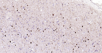 CALB2 Ready-To-Use IHC Kit
