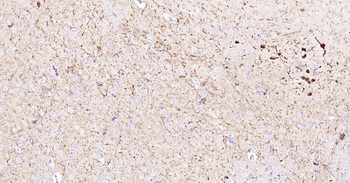 CALB2 Ready-To-Use IHC Kit