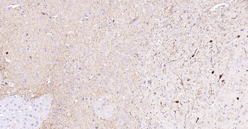 CALB2 Ready-To-Use IHC Kit