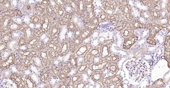 AQP1 Recombinant Rabbit Monoclonal Antibody