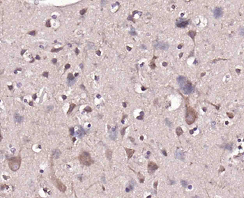 GSK3B Rabbit Polyclonal Antibody