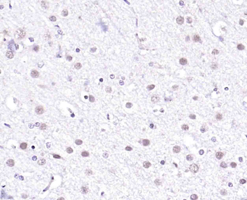 GSK3B Rabbit Polyclonal Antibody