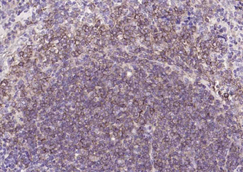 CD19 Rabbit Polyclonal Antibody