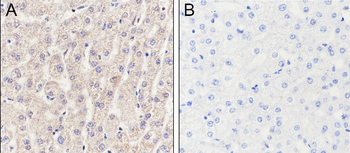 Acetyl Lysine Recombinant Rabbit Monoclonal Antibody