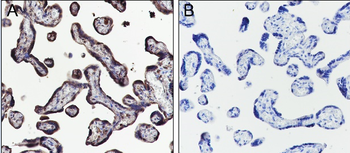 Benzoyllysine Mouse Monoclonal Antibody