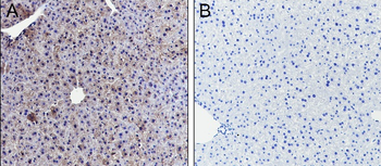 Benzoyllysine Mouse Monoclonal Antibody