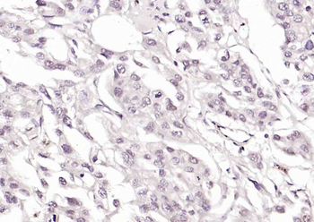 SOCS1 Mouse Monoclonal Antibody