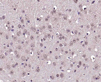 Phospho-alpha B Crystallin (Ser19) Rabbit Polyclonal Antibody
