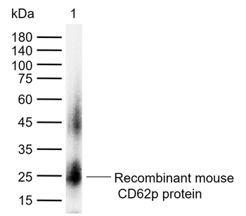 CD62p Rabbit Polyclonal Antibody