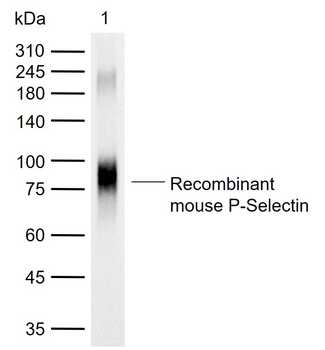 CD62p Rabbit Polyclonal Antibody