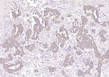 ACVRL1 Rabbit Polyclonal Antibody