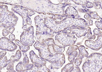 ACVRL1 Rabbit Polyclonal Antibody