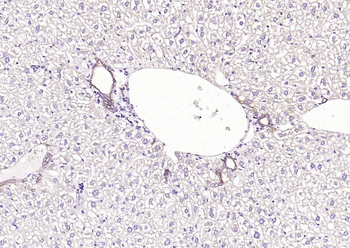 ACVRL1 Rabbit Polyclonal Antibody