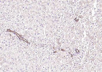 ACVRL1 Rabbit Polyclonal Antibody