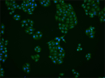 STK18 Rabbit Polyclonal Antibody