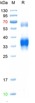 Recombinant human Clusterin protein, His