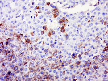C19orf54 Rabbit Polyclonal Antibody