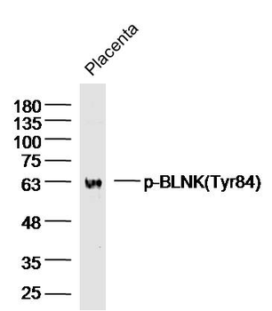 Phospho-BLNK (Tyr84) Rabbit Polyclonal Antibody