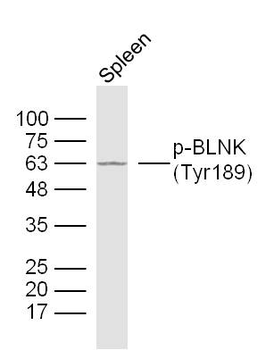 Phospho-BLNK (Tyr189) Rabbit Polyclonal Antibody