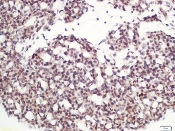 TFE3 Rabbit Polyclonal Antibody