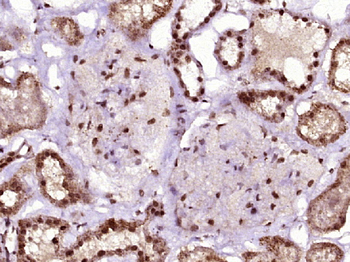 FRA10AC1 Rabbit Polyclonal Antibody