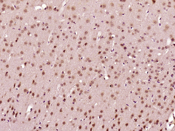 C1orf125 Rabbit Polyclonal Antibody