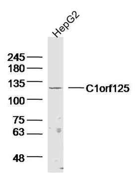 C1orf125 Rabbit Polyclonal Antibody